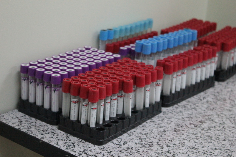 18 новых случаев заражения коронавирусом выявлено в Удмуртии